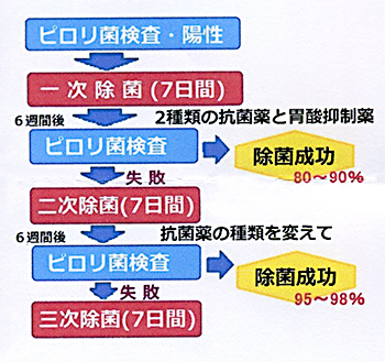 ピロリ菌検査キット　自宅で検査　大腸がん　胃がん